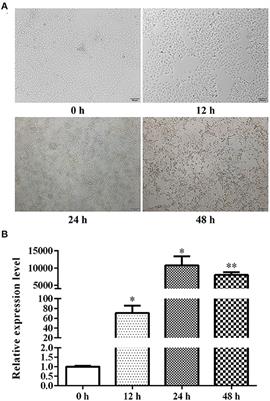 Genome-Wide DNA Methylome and Transcriptome Analysis of Porcine Testicular Cells Infected With Transmissible Gastroenteritis Virus